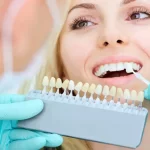 What Is The Average Cost Of A Dental Implants?